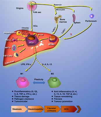 Hepatic Macrophage as a Key Player in Fatty Liver Disease